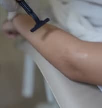 Pre-Treatment Preparation